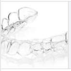 What is Malocclusion?